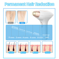 Thumbnail for FreezeGlow IPL Hair Removal Device